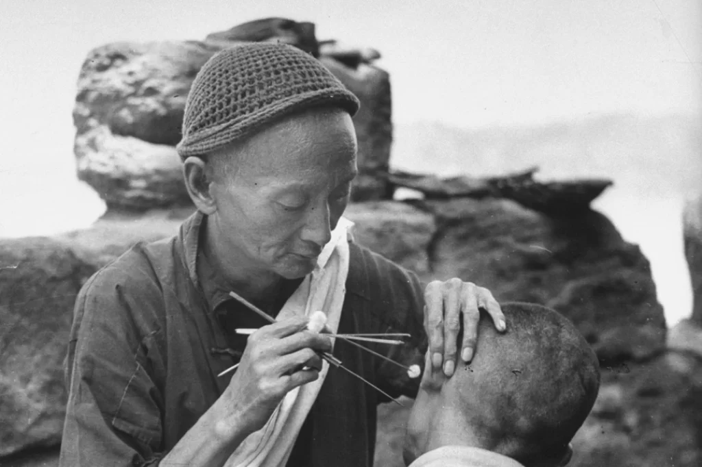 Un chinez face acupunctură pe urechea unui bărbat © Carl Mydans/The LIFE Picture Collection/Getty Images